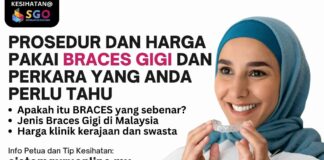 BRACES GIGI