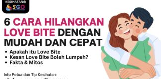 Cara Hilangkan Love Bite