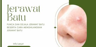5 Punca dan Gejala Jerawat Batu Beserta Cara Menghilangkan Jerawat Batu