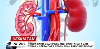 Tanda Sakit Buah Pinggang Dari Tahap 1 Dan Tahap 4 serta Cara Cegah Buah Pinggang Rosak Tanda Sakit Buah Pinggang Dari Tahap 1 Dan Tahap 4 serta Cara Cegah Buah Pinggang Rosak