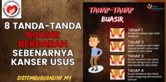 8 Tanda-tanda Buasir Berdarah Mungkin Sebenarnya Kanser Usus