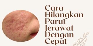 Cara Hilangkan Parut Jerawat Dengan Cepat Parut jerawat