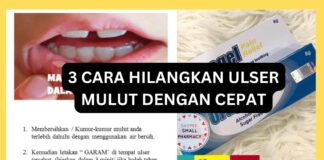 3 Cara Hilangkan Ulser Mulut Dengan Cepat