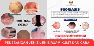 Penerangan Jenis-Jenis Ruam Kulit dan Cara Rawat Ruam Kulit