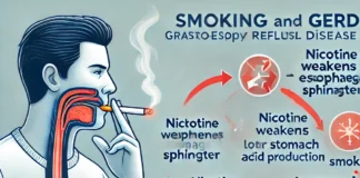 Adakah Rokok Penyebab GERD? Rokok Penyebab GERD